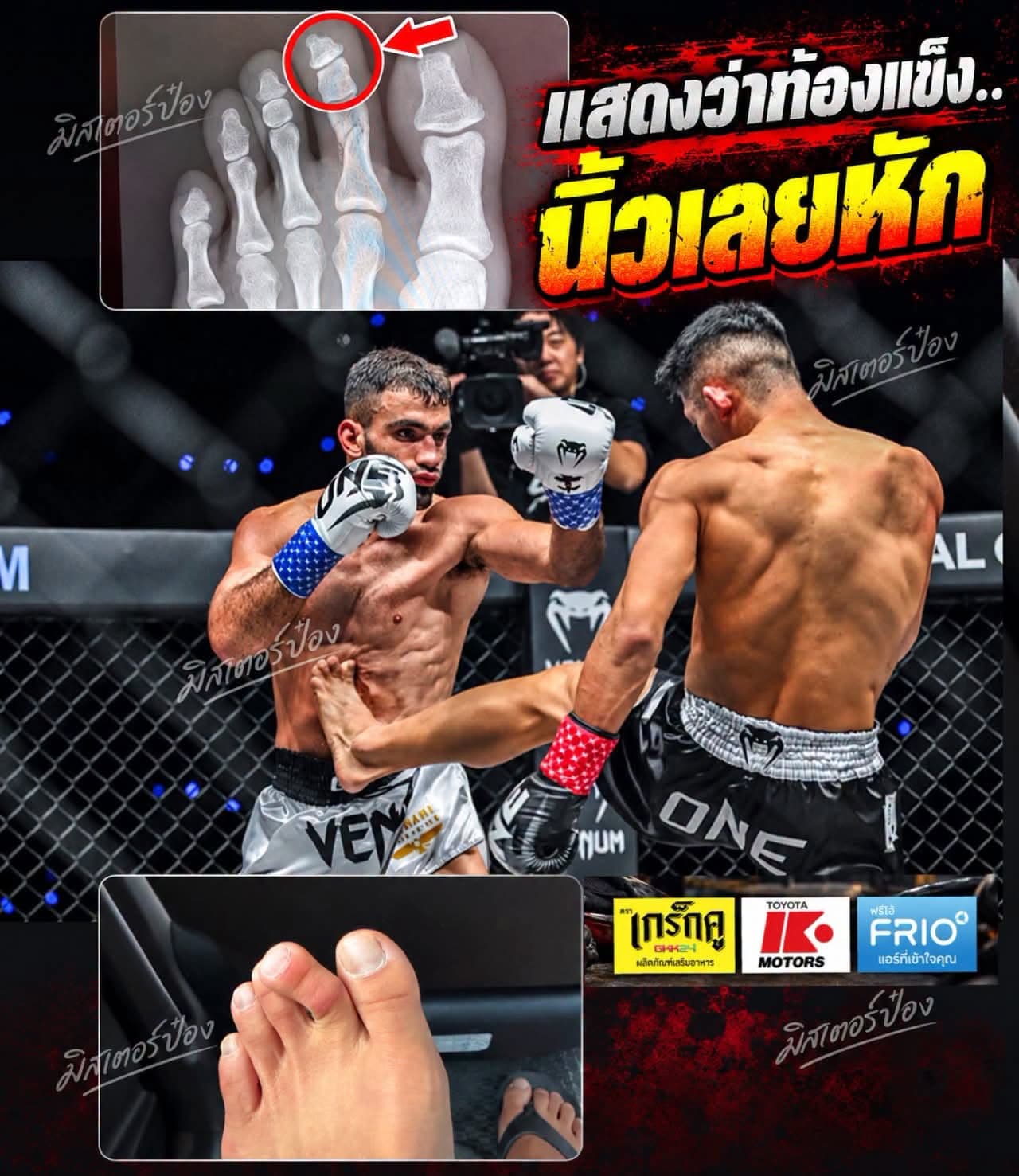 Masaaki Noiri fratura dedo e tem luta contra Marat Grigorian adiada no ONE Championship